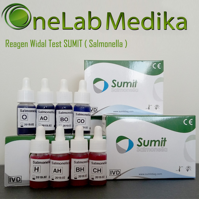 Reagen Widal Test SUMIT ( Salmonella )