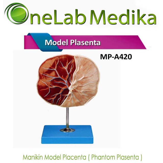 Manikin Model Placenta ( Phantom Plasenta )