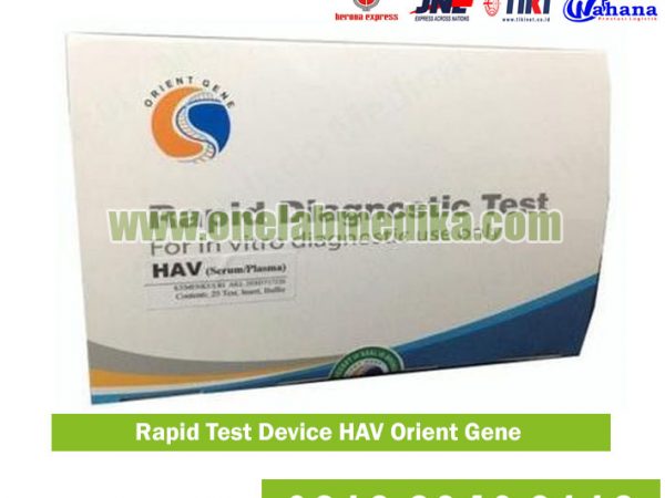Rapid Test HAV Hepatitis A Orient Gene akurat cepat untuk klinik, rumah sakit, laboratorium, puskesmas dan dinas kesehatan